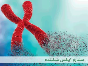 سندرم ایکس شکننده