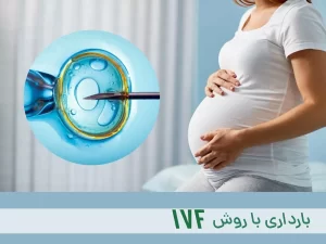 روش آی وی اف