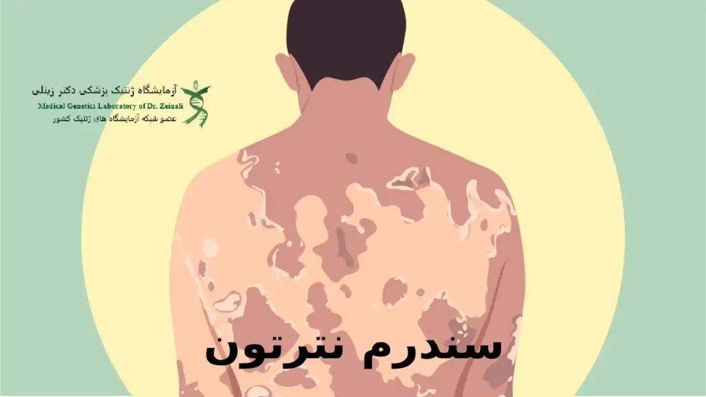 علائم سندرم نترتون