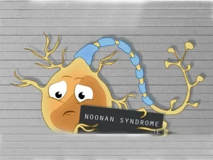 تشخیص و درمان سندروم نونان چگونه است؟