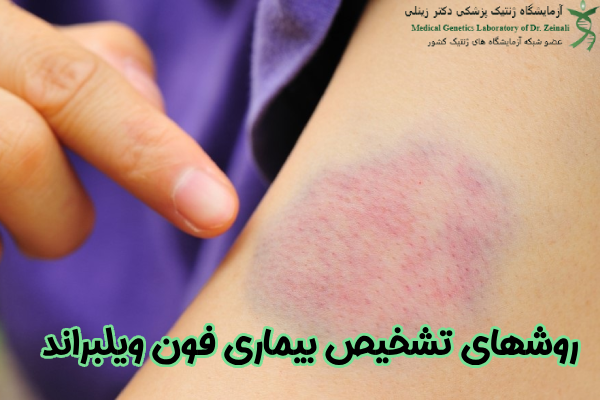 تشخیص بیماری فون ویلبراند