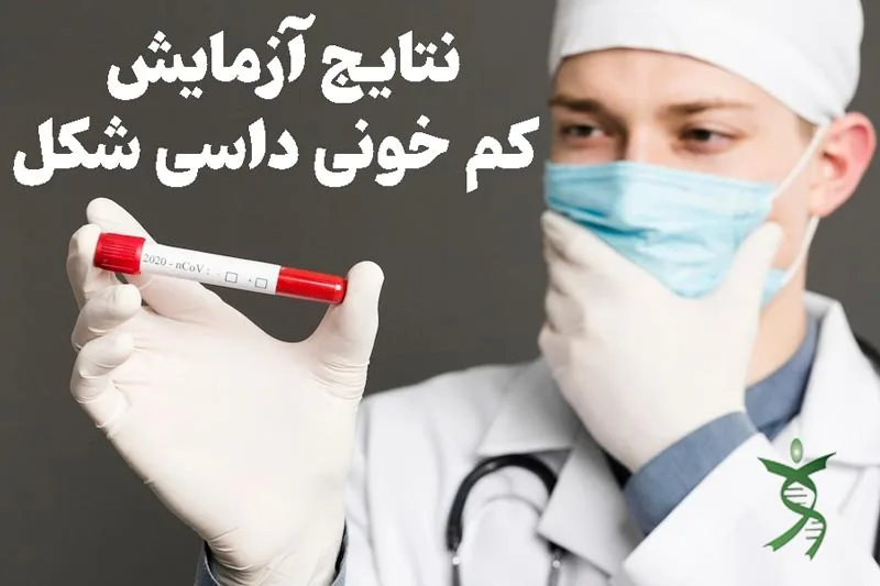 نتایج آزمایش کم خونی داسی شکل چگونه است؟