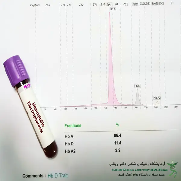 آزمایش الکتروفورز