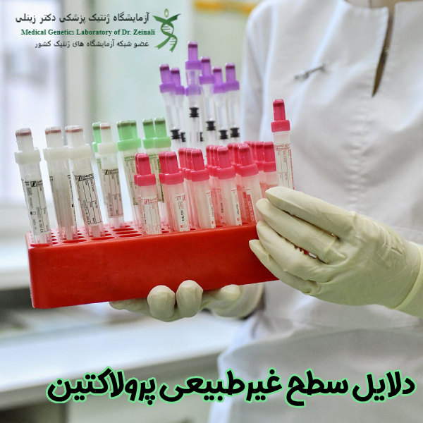 دلایل سطح غیرطبیعی پرولاکتین