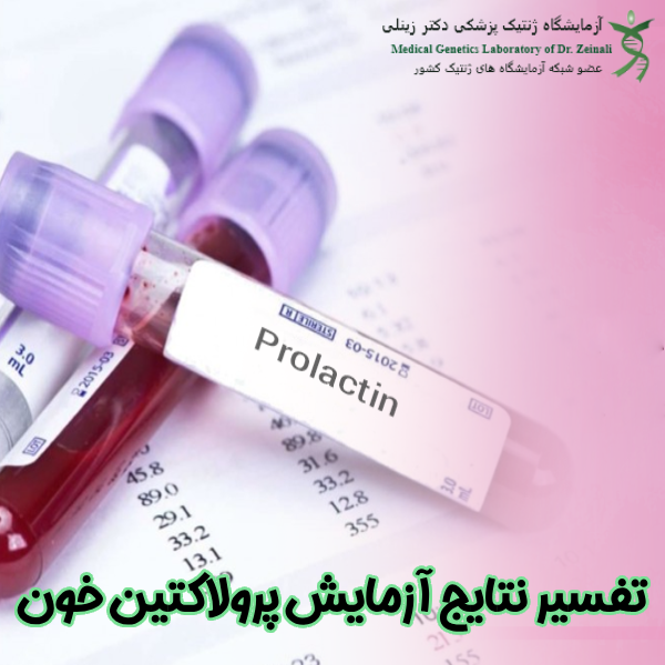 تفسیر نتایج آزمایش پرولاکتین خون