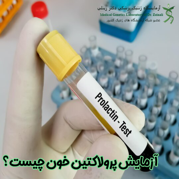 آزمایش پرولاکتین خون چیست