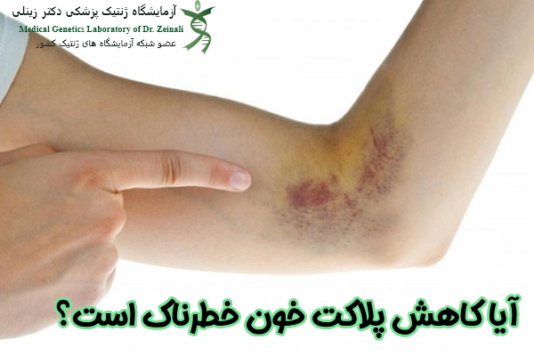 آیا کاهش پلاکت خون خطرناک است؟