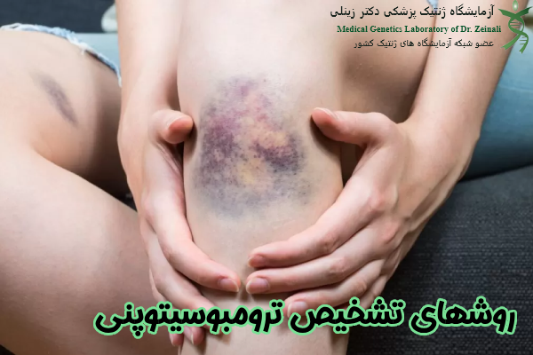 روشهای تشخیص ترومبوسیتوپنی