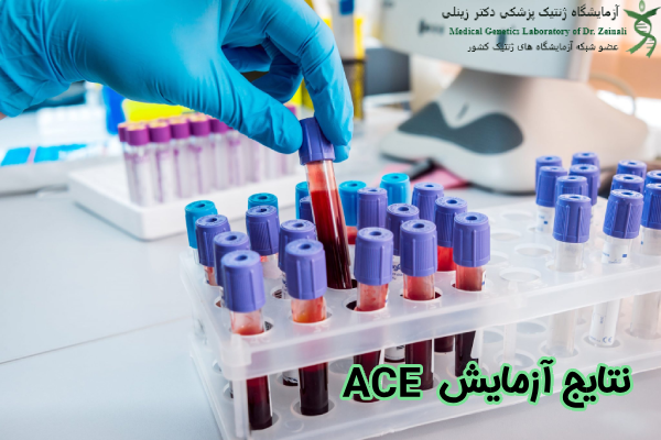 نتایج آزمایش ACE