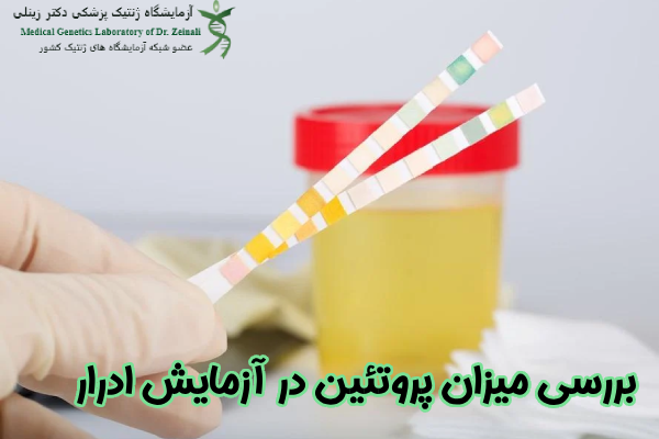 بررسی میزان پروتئین در آزمایش ادرار