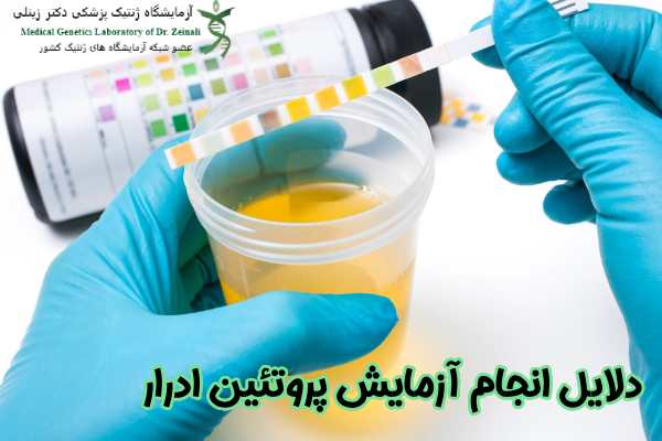 دلایل انجام آزمایش پروتئین ادرار