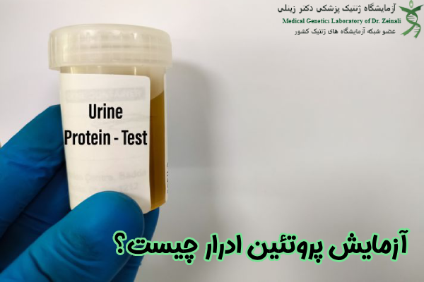 آزمایش پروتئین ادرار چیست