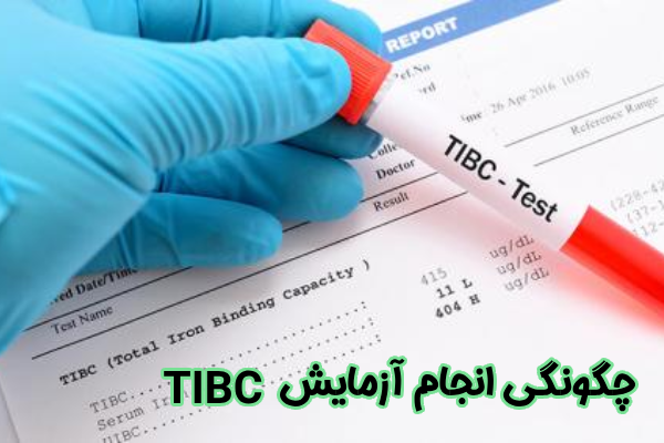 چگونگی انجام آزمایش خون TIBC