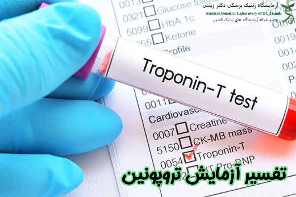 تفسیر آزمایش تروپونین