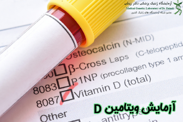آزمایش ویتامین دی چیست