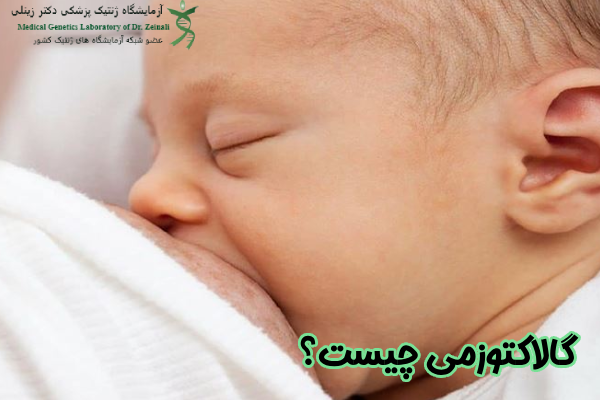گالاکتوزمی چیست