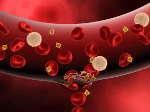 نقص فاکتور انعقادی 11