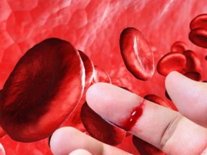 نقص فاکتور انعقادی 13