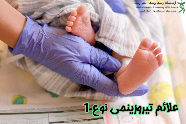 علائم تیروزینمی نوع 1