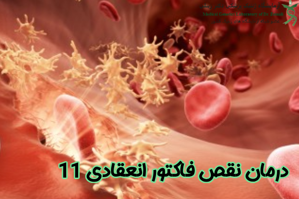 درمان نقص فاکتور انعقادی 11