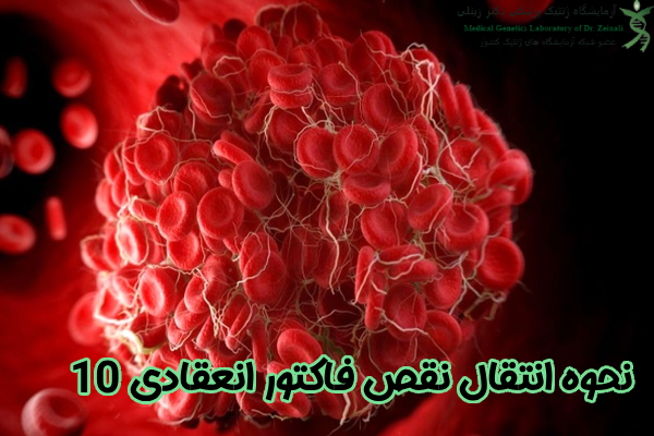 انتقال نقص فاکتور انعقادی 10