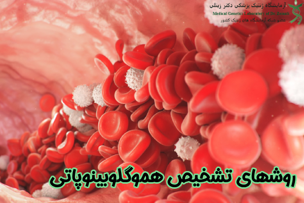 تشخیص هموگلوبینوپاتی
