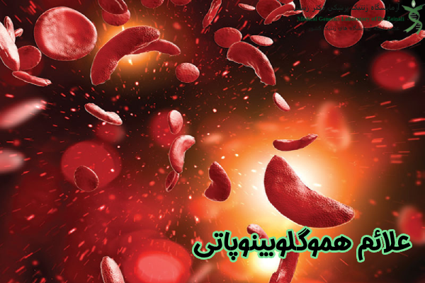 علائم هموگلوبینوپاتی