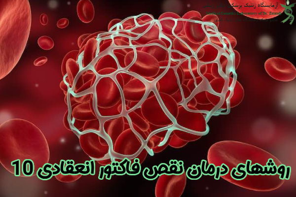 درمان نقص فاکتور انعقادی 10