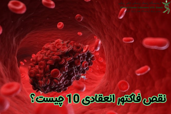 نقص فاکتور انعقادی 10 چیست؟