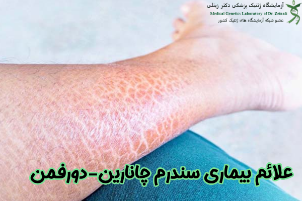 علائم سندرم چانارین-دورفمن