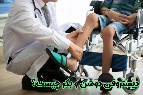 دیستروفی دوشن و بکر چیست؟