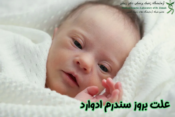 علت بروز سندرم ادوارد