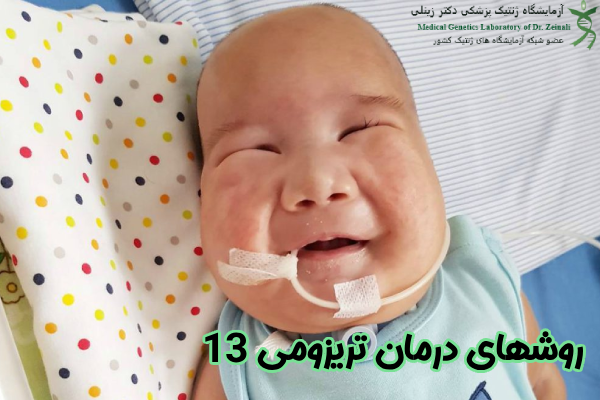 روشهای درمان تریزومی 13